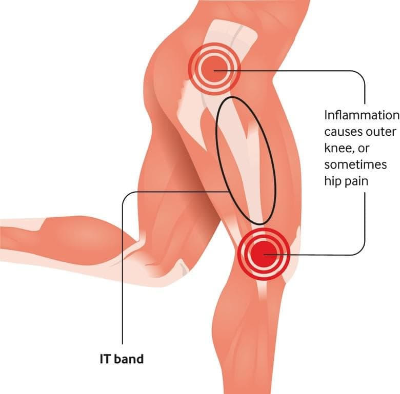 Injury Info