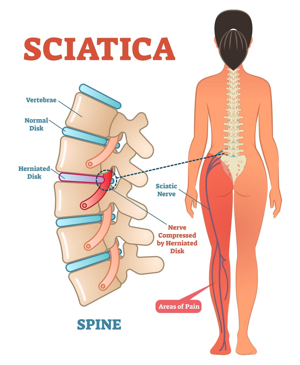 Injury Info