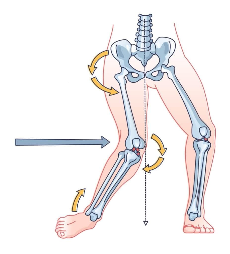 Injury Info