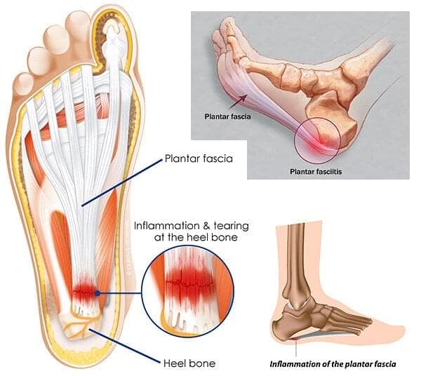 Injury Info