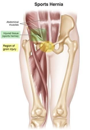 Injury Info